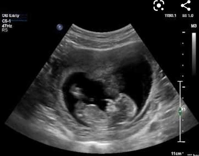 Screenshot_20201211-202555_Chrome